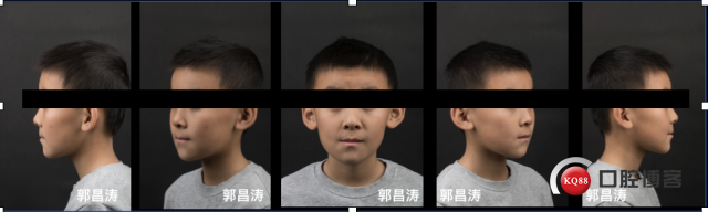 广东队18连胜是如何被吉林终结?广东VS吉林比赛回顾| 电竞官网(图1) LOL直播